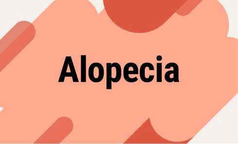 Alopecia