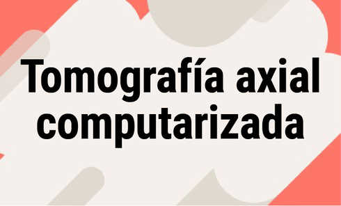 Tomografía axial computarizada
